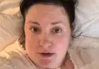Lena Dunham Shares Unexpected Plastic Surgery Advice from Dermatologist Before 40th Birthday