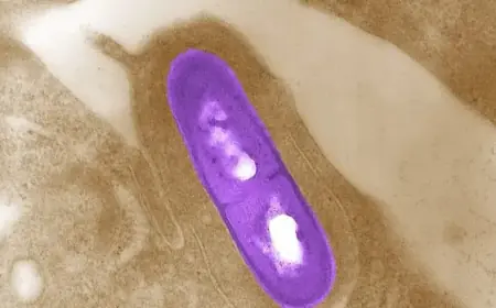 CFIA Recalls Salads, Cheeses, Meal Kits Due to Listeria Risk