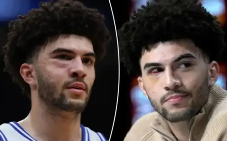 Cameron Boozer Endures Facial Fractures in UConn Defeat