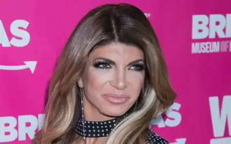 Teresa Giudice Stuns with Dramatic Facial Transformation