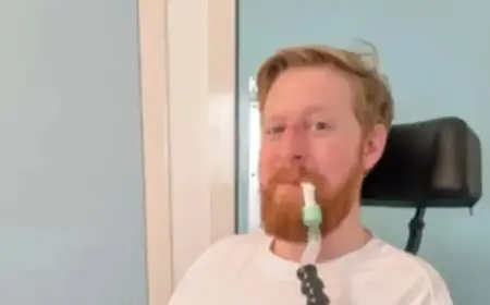 ‘Game of Thrones’ Star Michael Patrick Passes at 35: Motor Neuron Disease Explained