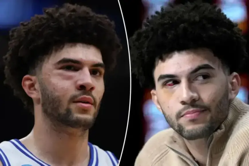 Cameron Boozer Endures Facial Fractures in UConn Defeat