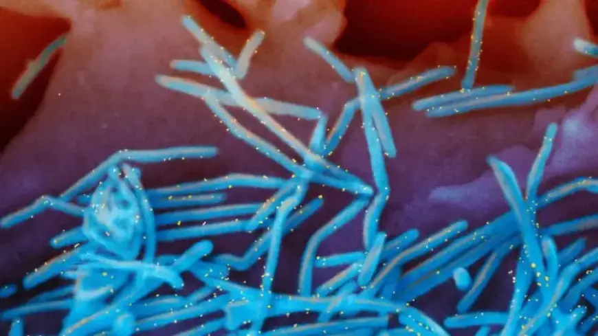 States Extend RSV Immunization Period Amidst Continued Spread