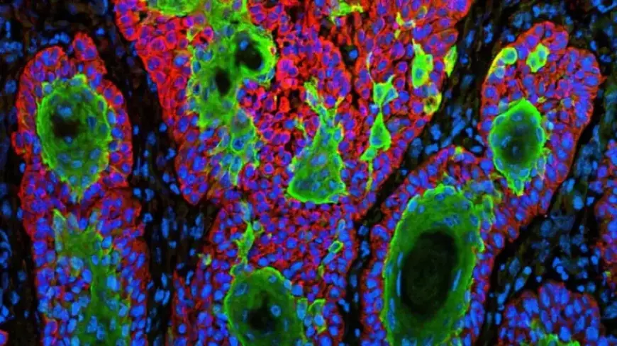 FDA Rejects Replimune’s Skin Cancer Drug Amid Ongoing Controversy