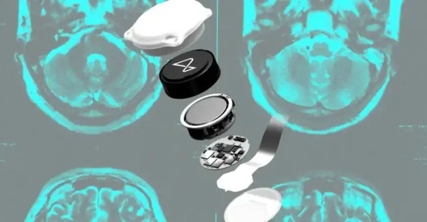 Has Neuralink Misstepped in Its Latest Venture?