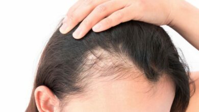 أفضل علاج لتساقط الشعر عند النساء