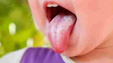 ارتفاع درجة الحرارة وظهور حبوب في الفم عند الأطفال